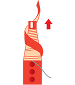content-dermatograph-03-1